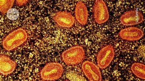 Mpox is spreading rapidly. Here are the questions researchers .